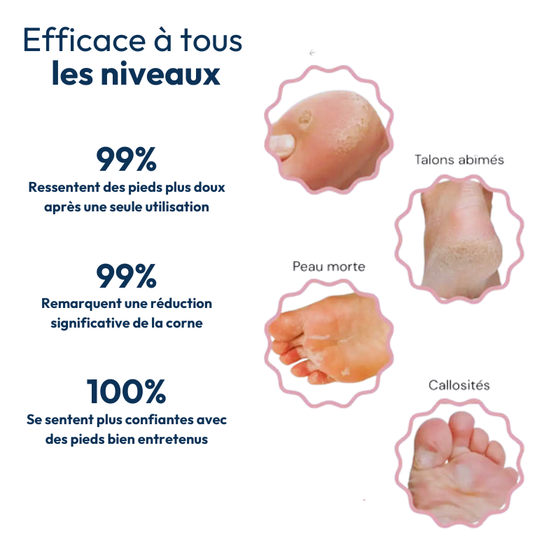 Masque peeling magique pour les pieds Ecovia France